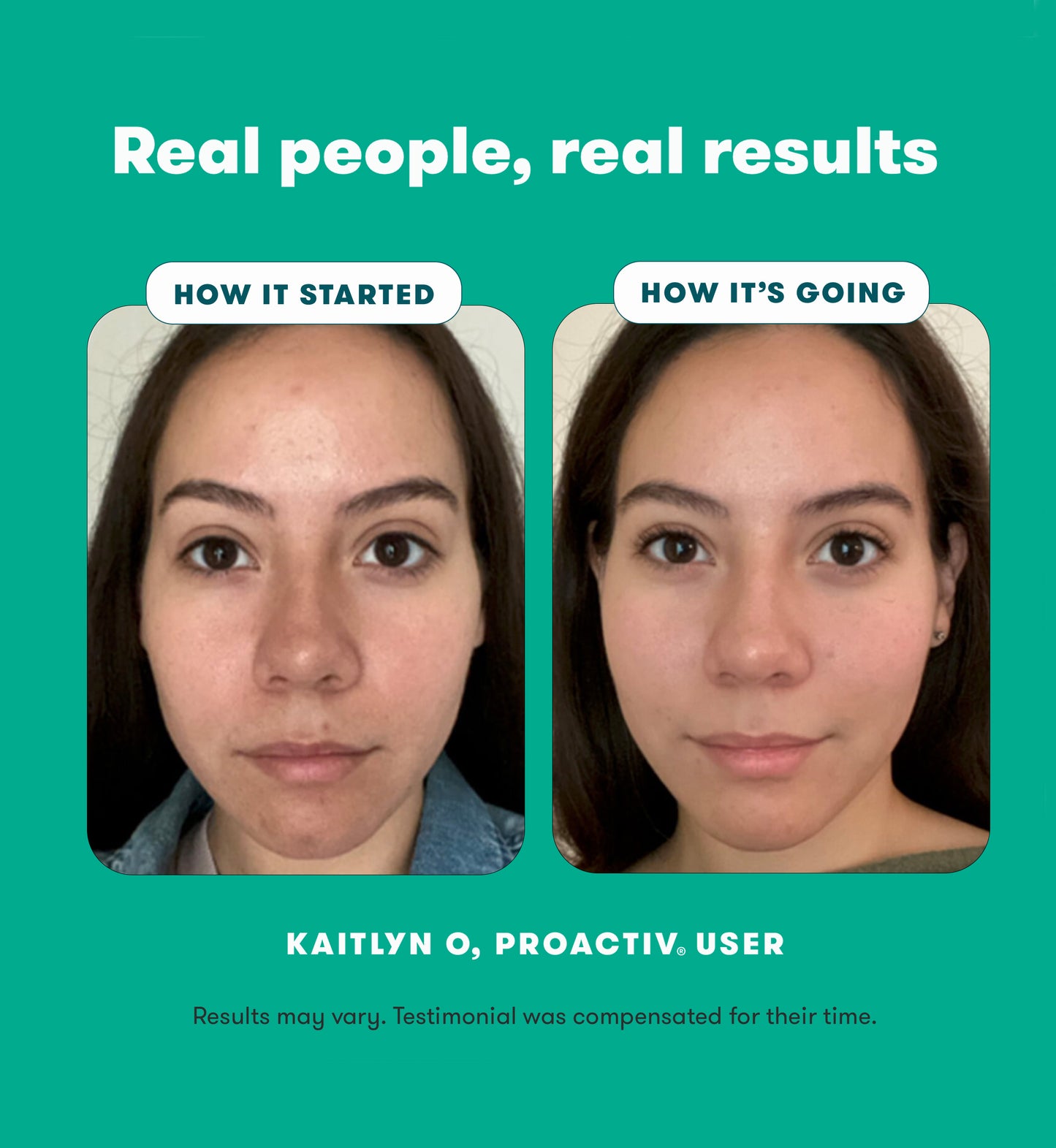 Proactiv Gentle 30 Day 3-Step Routine